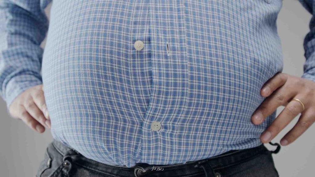 جراحی چاقی معده و انواع روش های جراحی لاغری