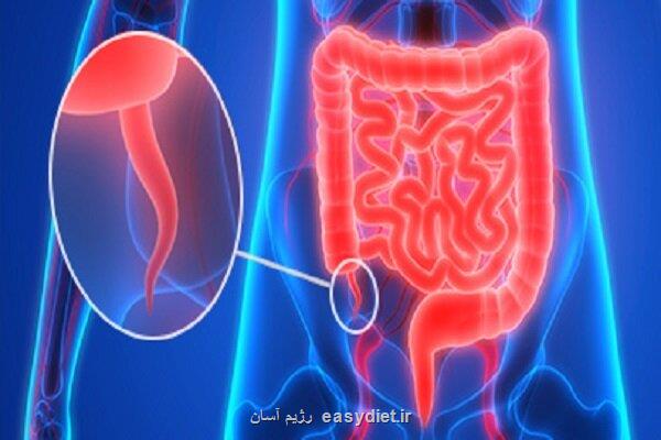 افزایش موارد سرطان آپاندیس در نسل جدید