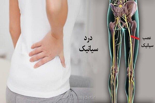 سیاتیک را با گرفتگی عضلات اشتباه نگیرید