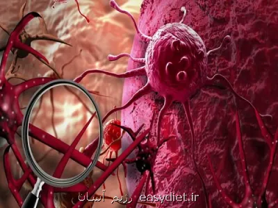 کاهش پیشرفت برخی سرطان ها با این دارو