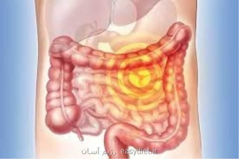 بیماری التهابی روده خطر سرطان پروستات را بیشتر می كند