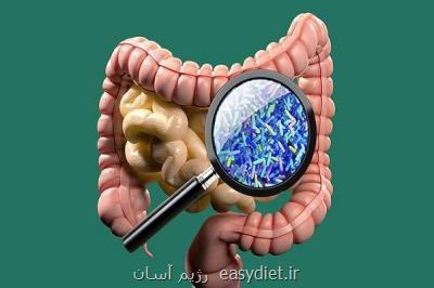 تاثیر رژیم غذایی پرچرب همراه با آنتی بیوتیك در بروز التهاب روده